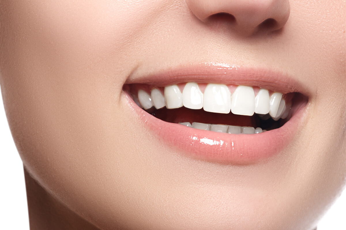 Professional Teeth Whitening Services in Jackson NJ Area